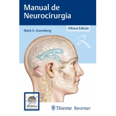 Manual de Neurocirurgia