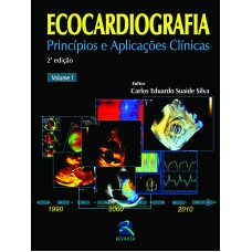 Ecocardiografia