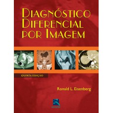 Diagnóstico Diferencial por Imagem