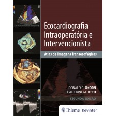 Ecocardiografia Intraoperatória e Intervencionista