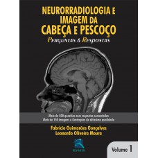 Neurorradiologia e Imagem da Cabeça e Pescoço