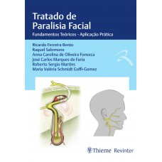 Tratado de Paralisia Facial