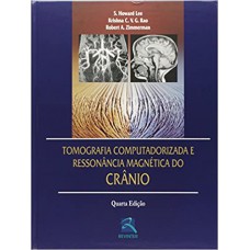 Tomografia Computadorizada e Ressonância Magnética do Crânio