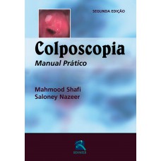 Colposcopia