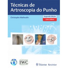 Técnicas de Artroscopia do Punho