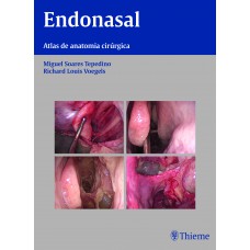 Endonasal