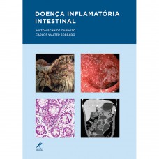 Doença inflamatória intestinal