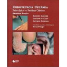 Criocirurgia cutânea