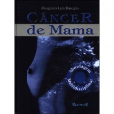 Câncer de Mama