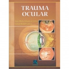 Trauma Ocular