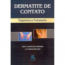 Dermatite de Contato