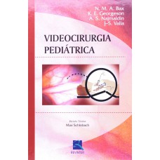 Videocirurgia Pediátrica