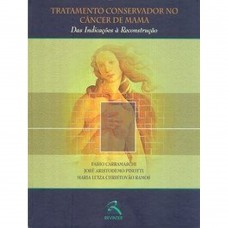 Tratamento Conservador no Câncer de Mama