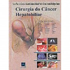 Cirurgia do Câncer Hepatobiliar