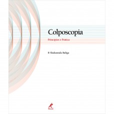 Colposcopia