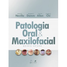 Patologia Oral e Maxilofacial