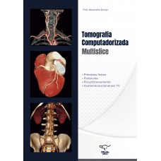 Tomografia Computadorizada Multislice