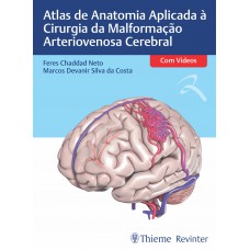 Atlas de Anatomia Aplicada à Cirurgia da Malformação Arteriovenosa Cerebral Atlas de Anatomia Aplicada à Cirurgia da Malformação Arteriovenosa Cerebral