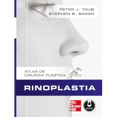 Rinoplastia