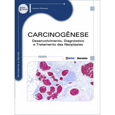 Carcinogênese