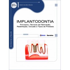 Implantodontia