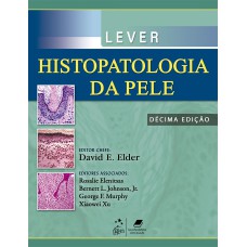 Lever - Histopatologia da Pele