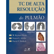 TC de alta resolução do pulmão