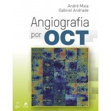 Angiografia por OCT