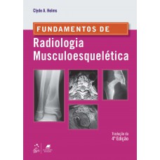 Fundamentos de Radiologia Musculoesquelética