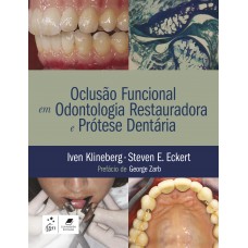 Oclusão Funcional em Odontologia Restauradora e Prótese Dentária