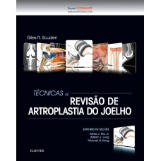 Técnicas de revisão de artroplastia do joelho