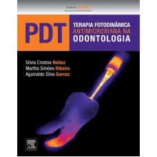 PDT - Terapia Fotodinâmica Antimicrobiana na Odontologia