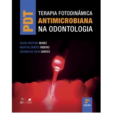 PDT - Terapia Fotodinâmica Antimicrobiana na Odontologia