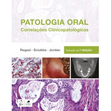 Patologia Oral